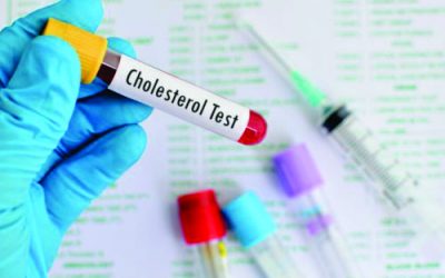 When last did you check your Cholesterol?